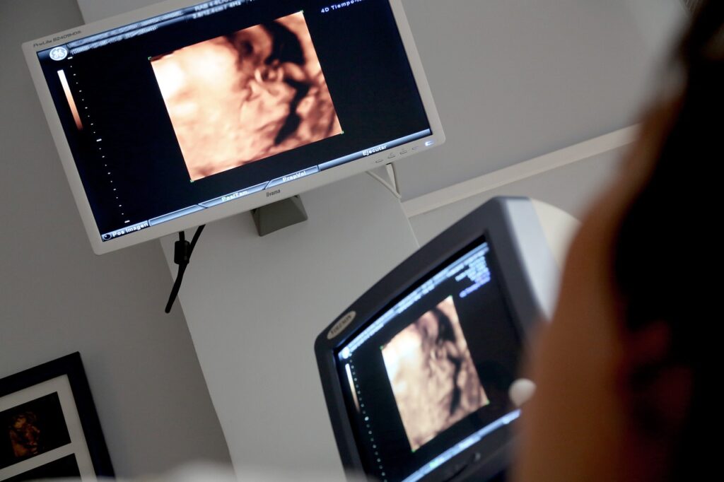 display ge12f9a2c2 1280 Euskadi detecta 12 patologías en su cribado neonatal frente a otras CCAA que analizan 40