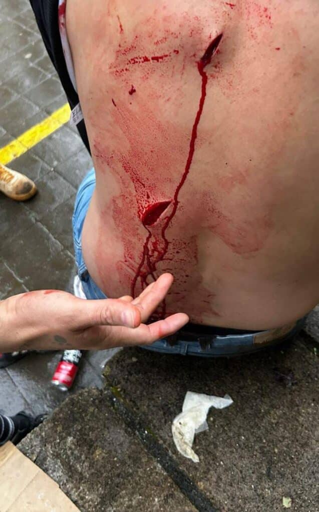 WhatsApp Image 2024 06 09 at 21.10.39 Agreden con un arma blanca al árbitro tras un partido en Bidebieta